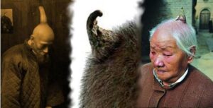 Zaskakujące ciekawostki medyczne o rogach skórnych – zobacz zdjęcia i poznaj ich tajemnice!