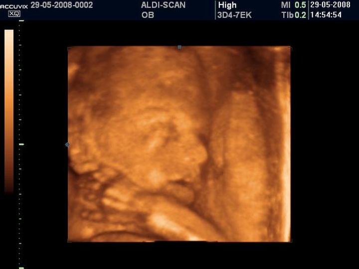 Rozwój dziecka w 27. tygodniu ciąży