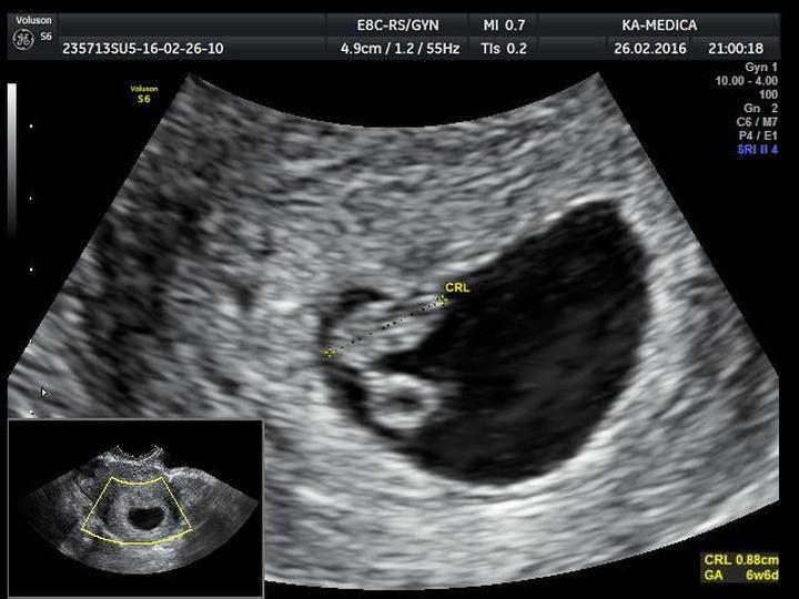 Zmiany w organizmie matki