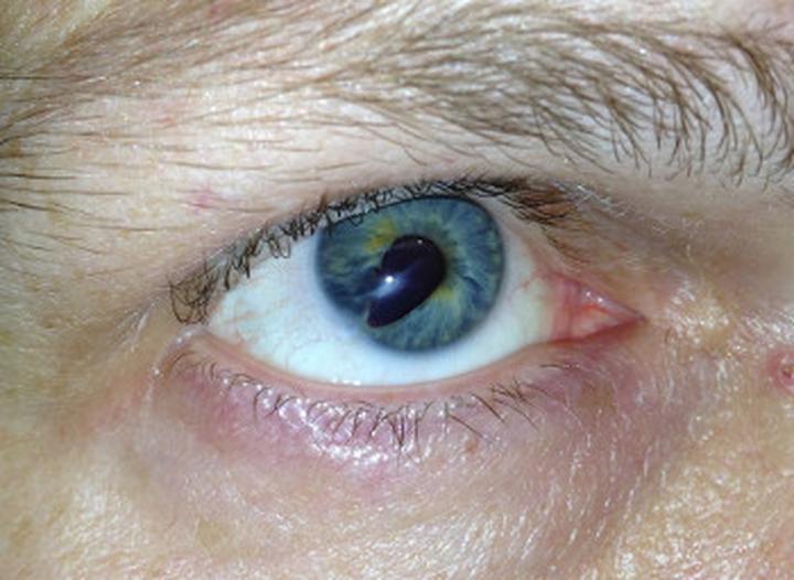 Wielkość źrenicy a percepcja